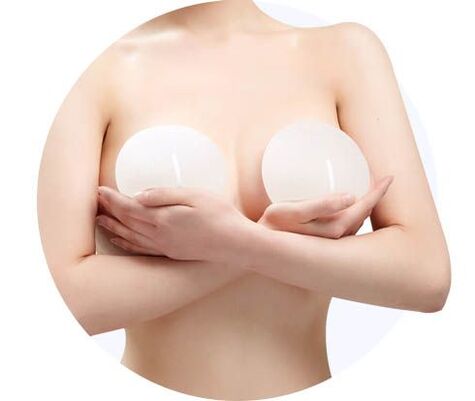 Увеличаване на гърдите с импланти